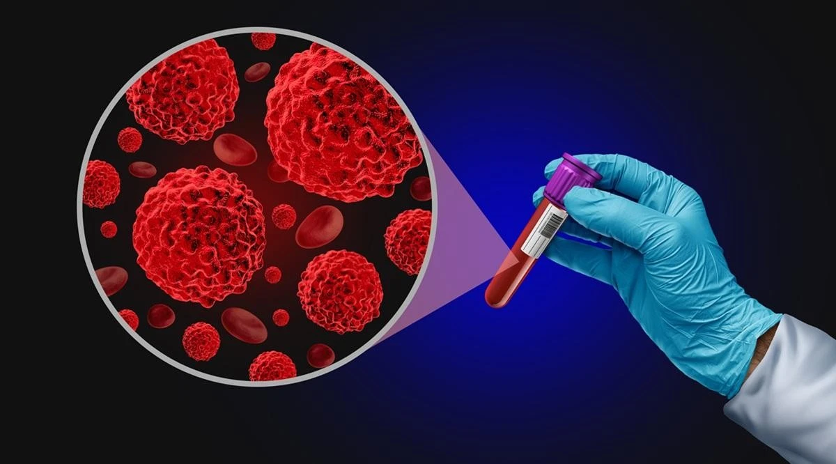 Blood Cancer Screening